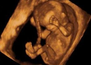 bébé 10 semaines